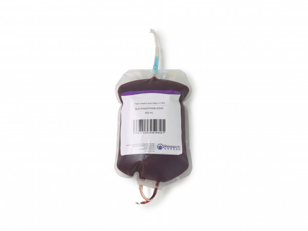 Fresh whole human blood in sodium citrate - female donor - chilled overnight delivery