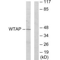 Anti-WTAP