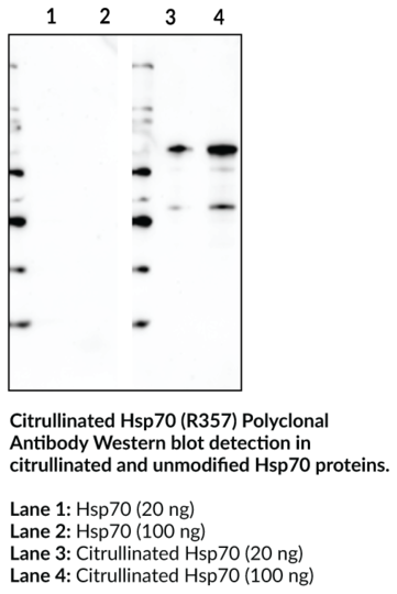 Anti-Citrullinated Hsp70 (R357)