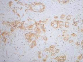 Anti-CTNNB1 Monoclonal