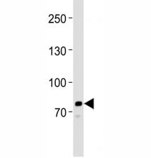 Anti-PCSK9