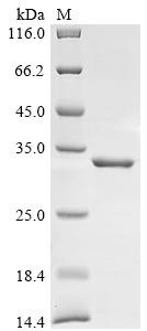 H-2 class II histocompatibility antigen,E-U alpha chain (H2-Ea), partial, mouse, recombinant