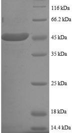 SUMO-conjugating enzyme UBC9 (UBE2I), partial, human, recombinant