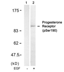 Anti-Phospho-PGR (Ser190)