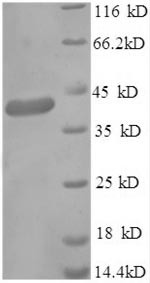 Gamma-aminobutyric acid receptor-associated protein (GABARAP), partial, human, recombinant