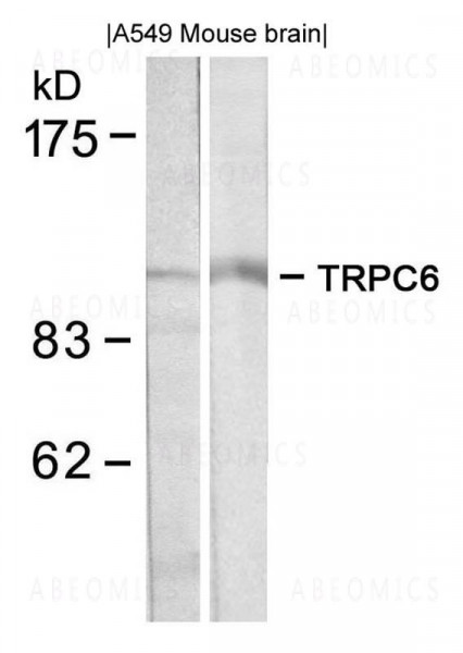 Anti-TRPC6