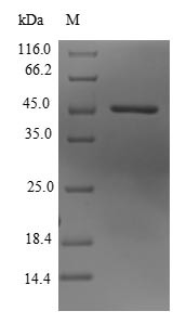 Lysine-specific demethylase 3B (KDM3B), partial, human, recombinant