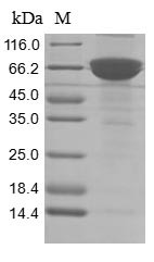 ADP-ribosyl cyclase/cyclic ADP-ribose hydrolase 1 (CD38), partial, human, recombinant