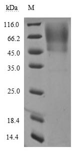 Spike glycoprotein (S), partial, Severe acute respiratory syndrome coronavirus 2, recombinant