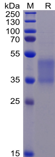 Human FCGR3A Protein (F176V), His Tag