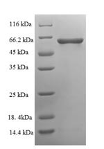 Serine/threonine-protein phosphatase 2B catalytic subunit gamma isoform (PPP3CC), partial, human, re