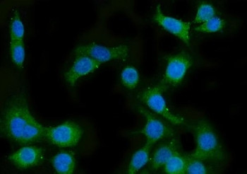 Anti-Lanosterol 14-alpha demethylase / CYP51A1