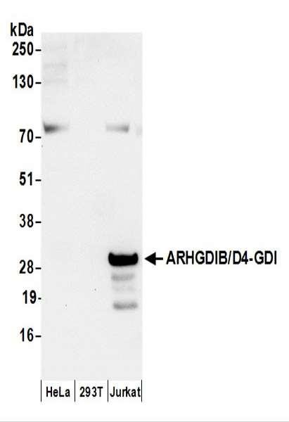 Anti-ARHGDIB/D4-GDI/RhoGDI2