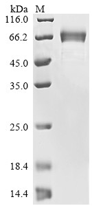 Novel Coronavirus Spike glycoprotein (S), partial, human, recombinant