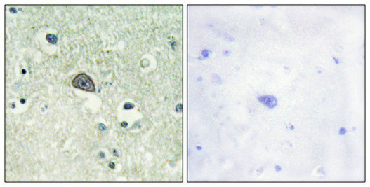 Anti-Phospho-GRIN1 (Ser890)