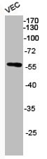 Anti-Phospho-AKT1/AKT2/AKT3 (S473)