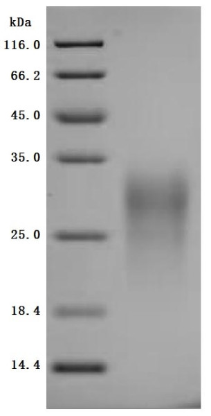 Gastric inhibitory polypeptide receptor (Gipr), partial (Active), mouse, recombinant