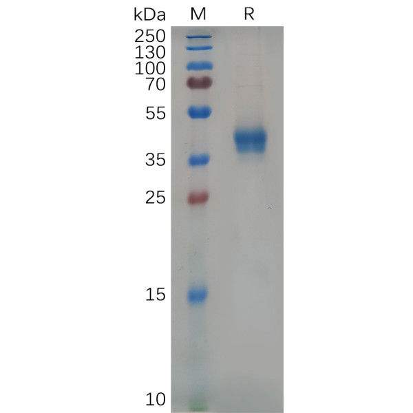 Mouse CD38 Protein, His Tag