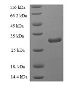 Group IID secretory phospholipase A2 (PLA2G2D), partial, human, recombinant