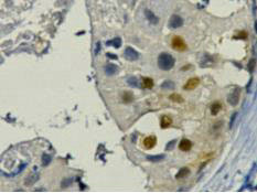 Anti-PCNA Monoclonal