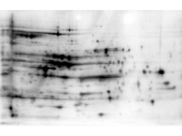 his tagged dhfr from e coli western blot results