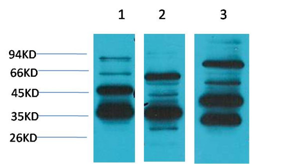 Anti-Angiotensin(1-7) Mas Receptor