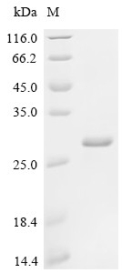 Low affinity immunoglobulin gamma Fc region receptor III-B (FCGR3B), human, recombinant