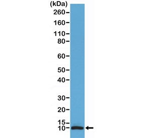 Anti-S100B (C-Terminal) (recombinant antibody), clone RM304