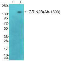 Anti-GRIN2B (Ab-1303)