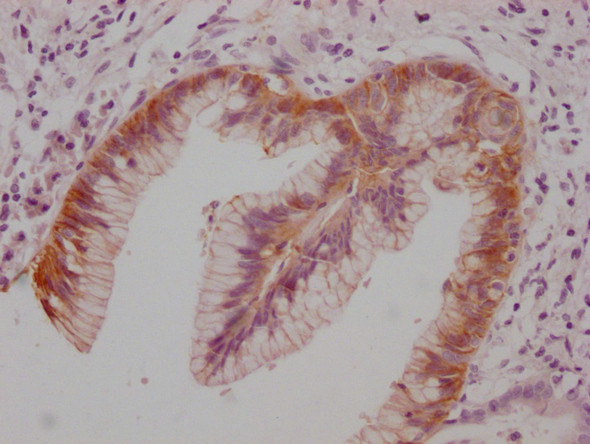 Anti-CLDN18 Monoclonal