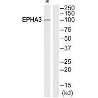 Anti-EPHA3 (Ab-602)