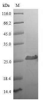 T-cell surface glycoprotein CD8 alpha chain (CD8A), partial, human, recombinant