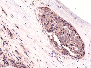 Anti-Beta-Catenin 1 (human), Rabbit Monoclonal (RM276)