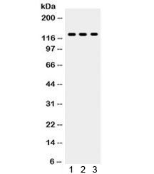 Anti-TLR7