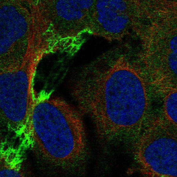 Anti-CHRNA5