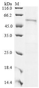 G2/mitotic-specific cyclin-B1 (CCNB1), human, recombinant