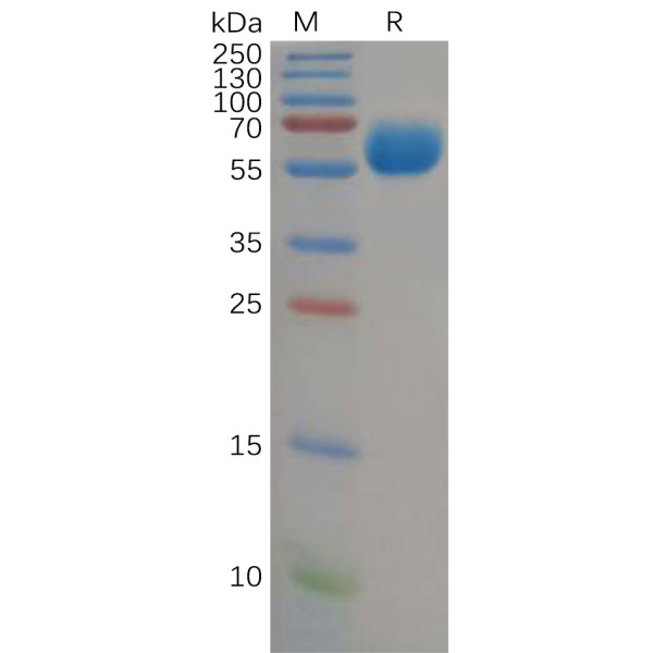 Human B7-H5 Protein, hFc Tag