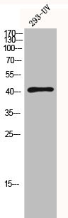 Anti-HDAC8