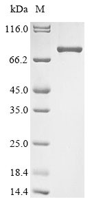 Zinc finger protein Helios (Ikzf2), mouse, recombinant