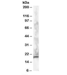 Anti-CABP1