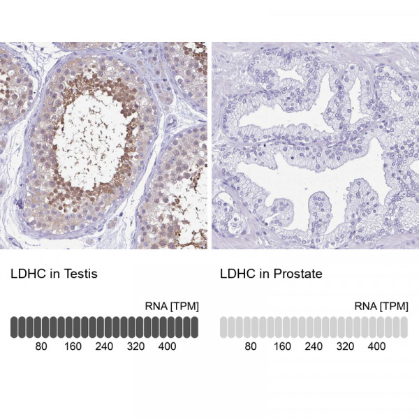 Anti-LDHC