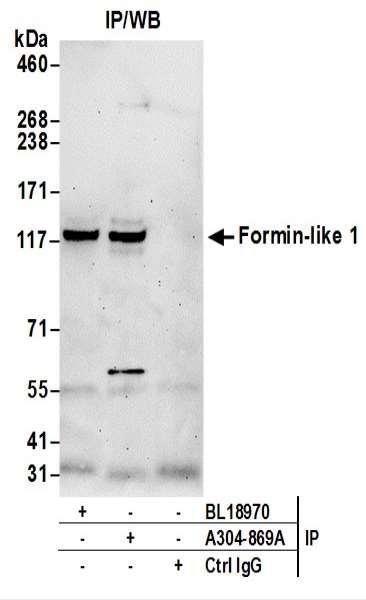 Anti-Formin-like 1/FMNL1