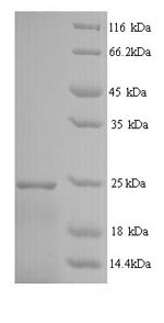 Interferon alpha-14 (IFNA14), human, recombinant