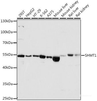 Anti-SHMT1