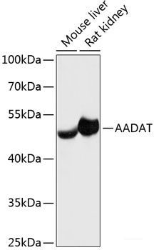 Anti-AADAT