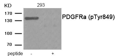 Anti-Phospho-PDGFRA (Tyr849)