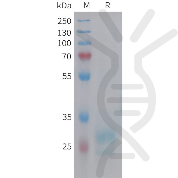 Human HMGB1 Protein, His Tag