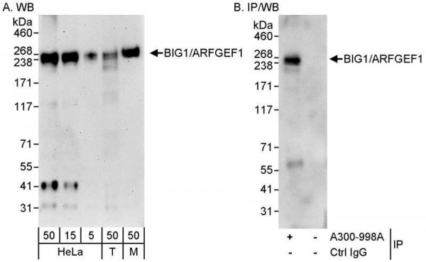 Anti-BIG1/ARFGEF1