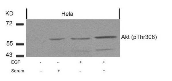 Anti-Phospho-AKT1 (Thr308)