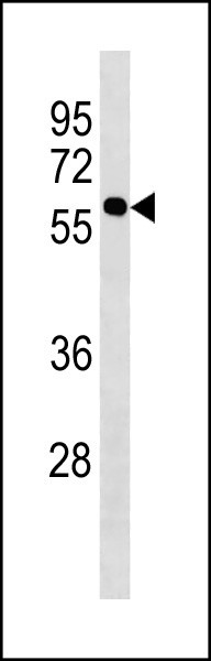 Anti-KISS1R / GRP54